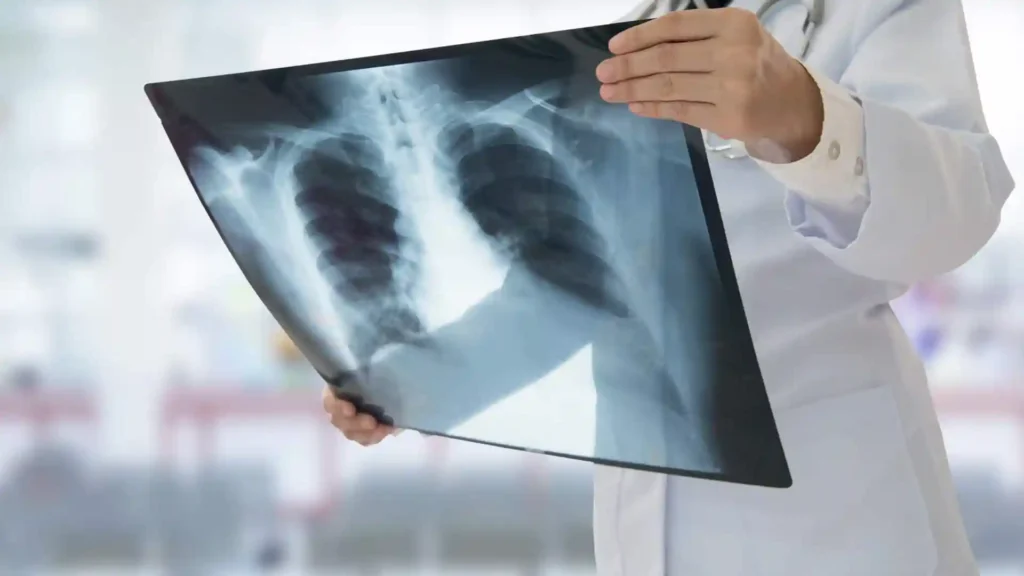 Latest advancements in Pulmonology Pulmonology